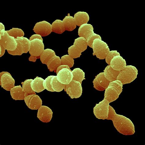 streptococcus pneumoniae bacteria